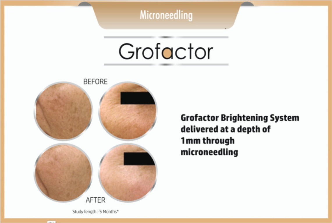 Grofactor Brightening System (4ml)